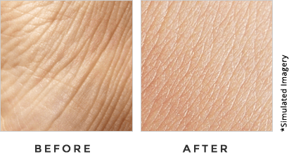 Triple Collagen Before and After Results